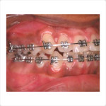 orthodontics-after